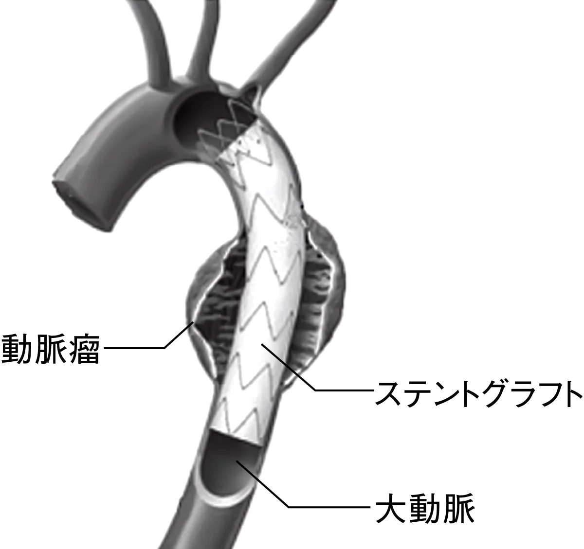 no11_explanatorydiagram